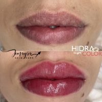 hidracolor
